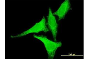 Immunofluorescence of monoclonal antibody to HSF2 on HeLa cell. (HSF2 抗体  (AA 1-230))