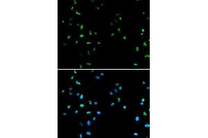 Immunofluorescence analysis of A549 cells using HDAC4 antibody. (HDAC4 抗体  (AA 530-630))