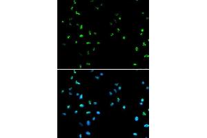 Immunofluorescence analysis of A549 cells using HDAC4 antibody.