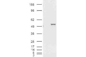 HEK293 overexpressing ALDH1A1 and probed with ABIN185587 (mock transfection in first lane). (ALDH1A1 抗体  (Internal Region))