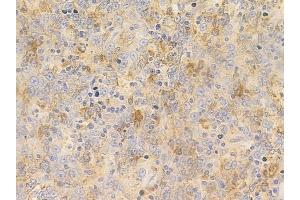 anti-BAI1-Associated Protein 2-Like-1 (BAIAP2L1) (Internal Region) antibody
