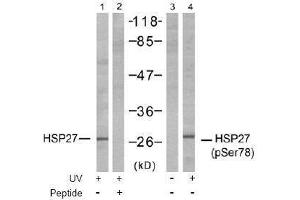 Image no. 1 for anti-Heat Shock 27kDa Protein 1 (HSPB1) (pSer78) antibody (ABIN197002) (HSP27 抗体  (pSer78))