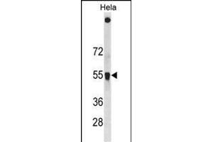 SQSTM1 Antibody (C-term ) (ABIN1881829 and ABIN2838612) western blot analysis in Hela cell line lysates (35 μg/lane). (SQSTM1 抗体  (C-Term))