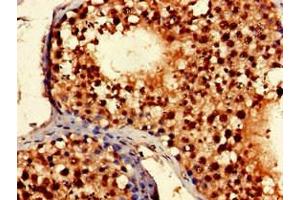 Immunohistochemistry of paraffin-embedded human testis tissue using ABIN7169201 at dilution of 1:100 (TLK2 抗体  (AA 23-234))