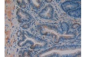 Immunohistochemistry (IHC) image for anti-Growth Factor Receptor-Bound Protein 7 (GRB7) (AA 298-489) antibody (ABIN7439495)