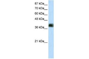 WB Suggested Anti-ZNF435 Antibody Titration:  2. (ZSCAN16 抗体  (Middle Region))