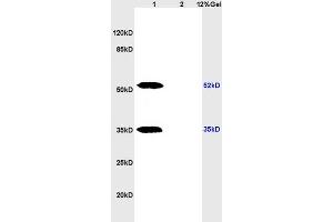 Lane 1: rat brain lysates Lane 2: rat heart lysates probed with Anti phospho-CHEK1(Ser317) Polyclonal Antibody, Unconjugated (ABIN757072) at 1:200 in 4 °C. (CHEK1 抗体  (pSer317))