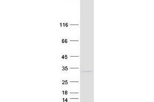 Western Blotting (WB) image for SPC24, NDC80 Kinetochore Complex Component, Homolog (SPC24) protein (Myc-DYKDDDDK Tag) (ABIN2732533)