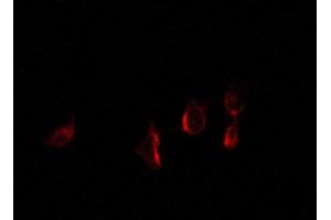 ABIN6267278 staining 293 by IF/ICC. (Estrogen Receptor alpha 抗体  (pSer118))