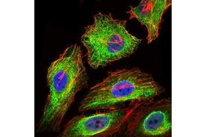 Immunofluorescence analysis of HeLa cells using GPC3 mouse mAb (green). (Glypican 3 抗体)