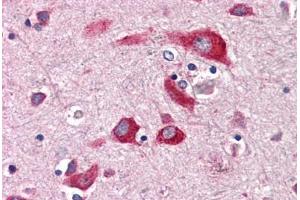 Anti-ENTPD2 antibody  ABIN1048566 IHC staining of human brain, cortex. (ENTPD2 抗体  (Internal Region))