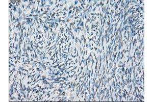 Image no. 11 for anti-P450 (Cytochrome) Oxidoreductase (POR) antibody (ABIN1497743) (POR 抗体)