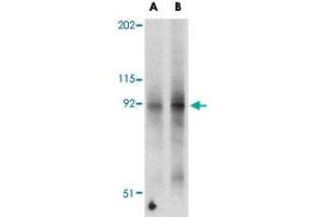 Western blot analysis of FNIP2 in mouse skeletal muscle tissue lysate with FNIP2 polyclonal antibody  at (A) 1 and (B) 2 ug/mL . (FNIP2 抗体  (N-Term))