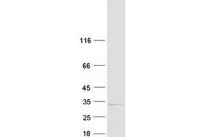 Western Blotting (WB) image for Spindlin Family, Member 2A (SPIN2A) protein (Myc-DYKDDDDK Tag) (ABIN2732585)