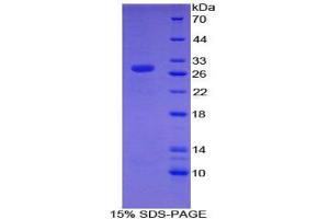 SDS-PAGE analysis of Mouse CHD3 Protein. (CHD3 蛋白)