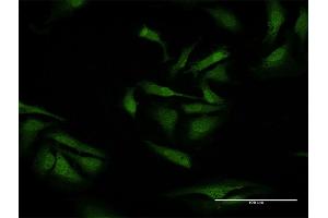 Immunofluorescence of purified MaxPab antibody to TXNDC9 on HeLa cell. (TXNDC9 抗体  (AA 1-188))