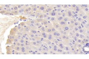 Detection of OGG1 in Mouse Liver Tissue using Polyclonal Antibody to Oxoguanine Glycosylase 1 (OGG1) (OGG1 抗体  (AA 31-345))
