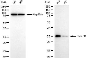 Western blotting analysis using SNRPB antibody (ABIN7800381).