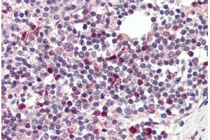 Human Spleen (formalin-fixed, paraffin-embedded) stained with TFEC antibody ABIN337184 at 5 ug/ml followed by biotinylated anti-goat IgG secondary antibody ABIN481715, alkaline phosphatase-streptavidin and chromogen. (TFEC 抗体  (AA 217-228))