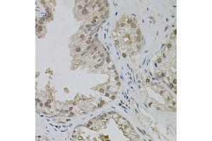 Immunohistochemistry of paraffin-embedded human prostate using MAPK1 antibody. (ERK2 抗体  (AA 200-300))