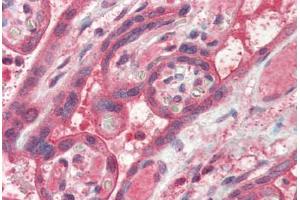 Human Placenta (formalin-fixed, paraffin-embedded) stained with FAIM antibody ABIN337178 at 2. (FAIM 抗体  (AA 121-132))