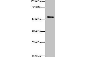 Western blot All lanes: TRIM38 antibody at 4 μg/mL + Jurkat whole cell lysate Secondary Goat polyclonal to rabbit IgG at 1/10000 dilution Predicted band size: 54 kDa Observed band size: 54 kDa (TRIM38 抗体  (AA 45-259))
