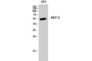 Western Blotting (WB) image for anti-Myelin Expression Factor 2 (MYEF2) (Ser89) antibody (ABIN3175957) (MYEF2 抗体  (Ser89))
