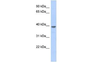 WB Suggested Anti-MED8 Antibody Titration: 0. (MED8 抗体  (N-Term))