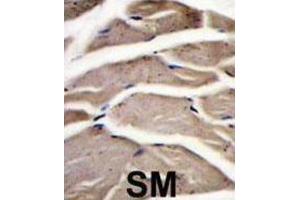 Immunohistochemistry (IHC) image for anti-phosphofructokinase, Muscle (PFKM) antibody (ABIN3003706) (PFKM 抗体)
