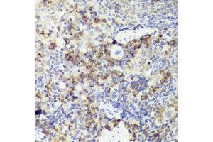 Immunohistochemistry of paraffin-embedded mouse spleen using IL18 antibody (ABIN7267992) at dilution of 1:50 (40x lens). (IL-18 抗体)