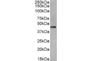 Western Blot using anti-CCR5 (phosphoserine 349) antibody E11/19. (Recombinant CCR5 抗体  (pSer349))