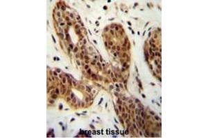 CI150 Antibody (N-term) immunohistochemistry analysis in formalin fixed and paraffin embedded human breast tissue followed by peroxidase conjugation of the secondary antibody and DAB staining. (CI150 抗体  (N-Term))