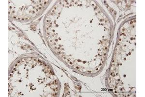 Image no. 1 for anti-Checkpoint Kinase 2 (CHEK2) (AA 1-544) antibody (ABIN599174) (CHEK2 抗体  (AA 1-544))