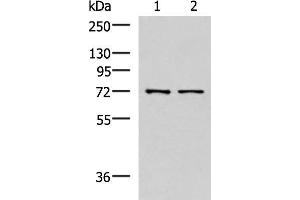 Western blot analysis of Mouse liver tissue and Jurkat cell lysates using MKS1 Polyclonal Antibody at dilution of 1:700 (MKS1 抗体)