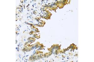 Immunohistochemistry of paraffin-embedded mouse lung using DEFB4A antibody (ABIN5974965) at dilution of 1/100 (40x lens). (DEFB4A 抗体)
