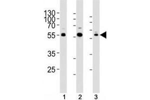 Western blot analysis of lysate from human (1) Jurkat, (2) PC3, and rat (3) C6 cells using AKT1/2/3 antibody at 1:1000. (AKT 1/2/3 抗体  (AA 278-312))