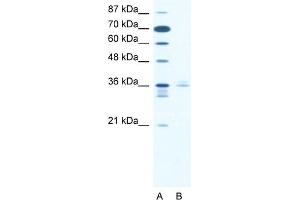 WB Suggested Anti-LHX3 Antibody   Titration: 2. (LHX3 抗体  (Middle Region))