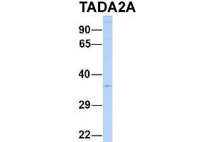 Host:  Rabbit  Target Name:  TADA2A  Sample Type:  721_B  Antibody Dilution:  1. (TADA2L 抗体  (N-Term))