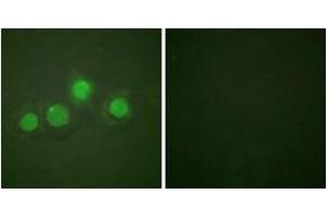 Immunofluorescence analysis of HuvEc cells, using GATA4 (Phospho-Ser262) Antibody. (GATA4 抗体  (pSer262))