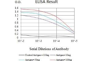 Black line: Control Antigen (100 ng),Purple line: Antigen (10 ng), Blue line: Antigen (50 ng), Red line:Antigen (100 ng) (PIK3R4 抗体  (AA 772-906))