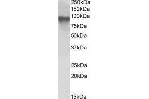 AP23665PU-N TORC2 antibody staining of Jurkat lysate at 1 µg/ml (35 µg protein in RIPA buffer). (CRTC2 抗体  (C-Term))