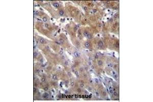 ANKRD18B Antibody (N-term) (ABIN655769 and ABIN2845209) immunohistochemistry analysis in formalin fixed and paraffin embedded human liver tissue followed by peroxidase conjugation of the secondary antibody and DAB staining. (ANKRD18B 抗体  (N-Term))