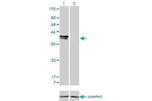 Western blot analysis of ISL1 over-expressed 293 cell line, cotransfected with ISL1 Validated Chimera RNAi (Lane 2) or non-transfected control (Lane 1). (ISL1 抗体  (AA 63-159))
