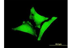 Immunofluorescence of monoclonal antibody to WBP1 on HeLa cell. (WBP1 抗体  (AA 170-267))
