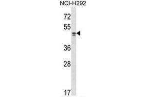 TADA2L Antibody (Center) western blot analysis in NCI-H292 cell line lysates (35µg/lane). (TADA2L 抗体  (Middle Region))