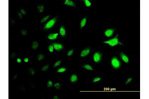 Immunofluorescence (IF) image for anti-Proteasome (Prosome, Macropain) 26S Subunit, ATPase, 2 (PSMC2) (AA 1-433) antibody (ABIN562486)