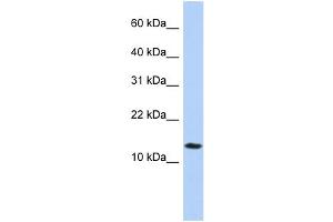 WB Suggested Anti-FAM14A Antibody Titration:  0. (IFI27L2 抗体  (Middle Region))