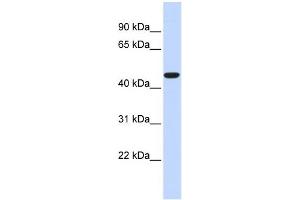 WB Suggested Anti-ACOT2 Antibody Titration: 0. (ACOT2 抗体  (Middle Region))