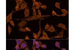 Immunofluorescence analysis of HeLa cells using USP15 Polyclonal Antibody at dilution of 1:100 (40x lens). (USP15 抗体)