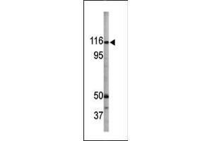 Image no. 1 for anti-Retinoblastoma-Like 1 (p107) (RBL1) (pSer975) antibody (ABIN358209) (p107 抗体  (pSer975))